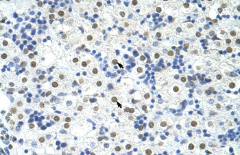 TARDBP Rabbit Polyclonal Antibody