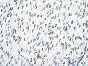 TARDBP Rabbit Polyclonal Antibody