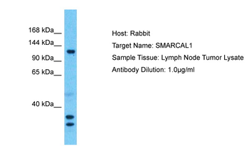 SMARCAL1 Rabbit Polyclonal Antibody