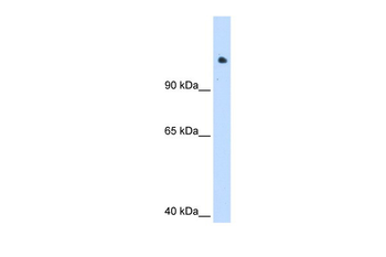 SMARCAL1 Rabbit Polyclonal Antibody
