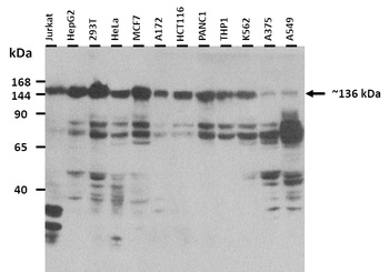 ZEB2 Rabbit Polyclonal Antibody