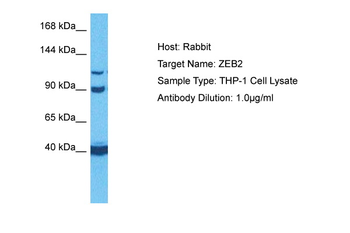 ZEB2 Rabbit Polyclonal Antibody