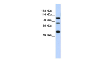 ZEB2 Rabbit Polyclonal Antibody
