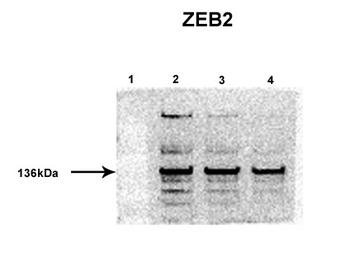 ZEB2 Rabbit Polyclonal Antibody
