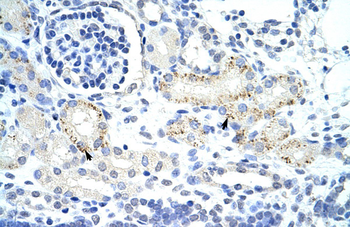 GTF2IRD1 Rabbit Polyclonal Antibody