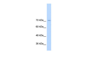GTF2IRD1 Rabbit Polyclonal Antibody