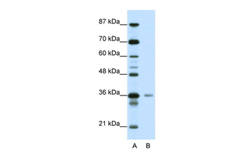 HMG20A Rabbit Polyclonal Antibody