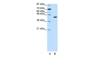PGBD1 Rabbit Polyclonal Antibody