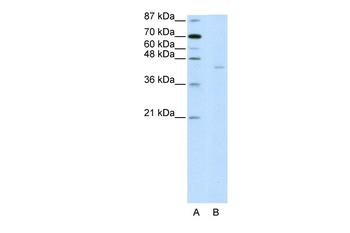 PGBD1 Rabbit Polyclonal Antibody