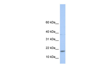 MAX Rabbit Polyclonal Antibody