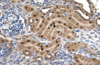 MLX Rabbit Polyclonal Antibody