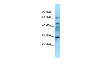 Eya4 Rabbit Polyclonal Antibody