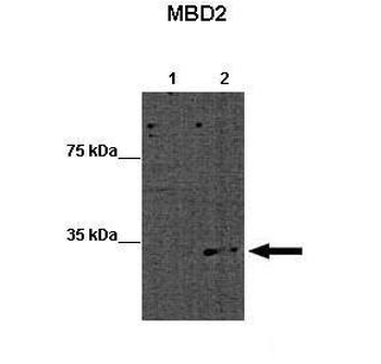 MBD2 Rabbit Polyclonal Antibody