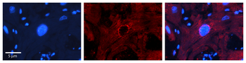 MBD2 Rabbit Polyclonal Antibody