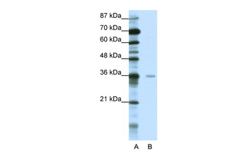 MBD2 Rabbit Polyclonal Antibody