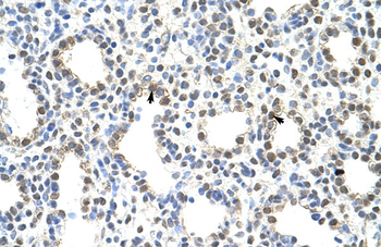PRMT5 Rabbit Polyclonal Antibody