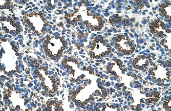 RPL8 Rabbit Polyclonal Antibody