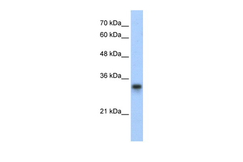 RPL8 Rabbit Polyclonal Antibody