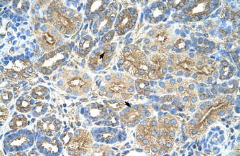 RPL8 Rabbit Polyclonal Antibody
