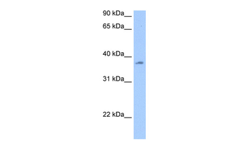 RBMY1A1 Rabbit Polyclonal Antibody