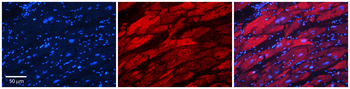 AARS Rabbit Polyclonal Antibody