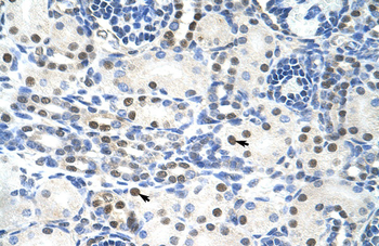 TROVE2 Rabbit Polyclonal Antibody