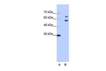 TROVE2 Rabbit Polyclonal Antibody