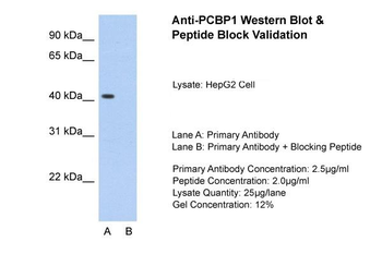 PCBP1 Rabbit Polyclonal Antibody