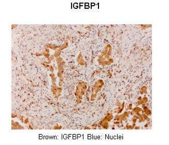 IGF2BP1 Rabbit Polyclonal Antibody