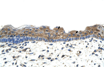 APOBEC2 Rabbit Polyclonal Antibody