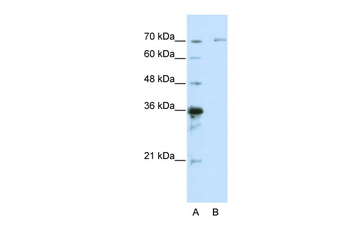 IRAK3 Rabbit Polyclonal Antibody