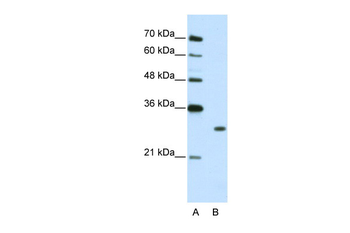 MBNL1 Rabbit Polyclonal Antibody