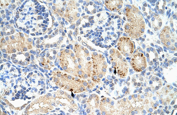 FZD7 Rabbit Polyclonal Antibody