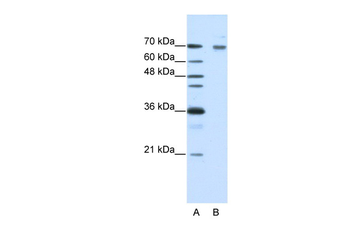 FZD7 Rabbit Polyclonal Antibody