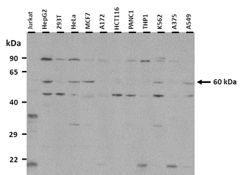 FZD4 Rabbit Polyclonal Antibody