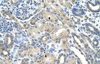 PRPS2 Rabbit Polyclonal Antibody