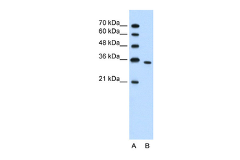PRPS2 Rabbit Polyclonal Antibody