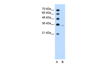 PRPS2 Rabbit Polyclonal Antibody