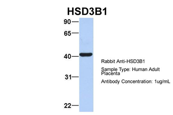 HSD3B1 Rabbit Polyclonal Antibody