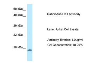 OXT Rabbit Polyclonal Antibody