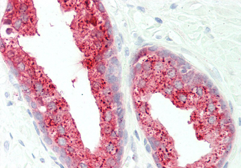ACPP Rabbit Polyclonal Antibody