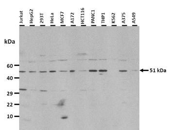 CHGA Rabbit Polyclonal Antibody