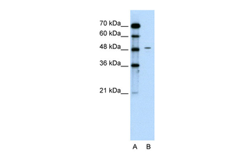 CHGA Rabbit Polyclonal Antibody
