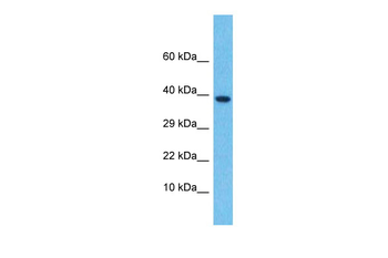 LEFTY2 Rabbit Polyclonal Antibody