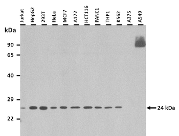 BAG2 Rabbit Polyclonal Antibody