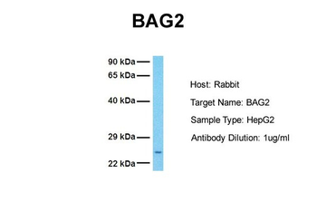BAG2 Rabbit Polyclonal Antibody