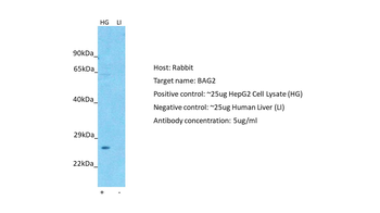 BAG2 Rabbit Polyclonal Antibody