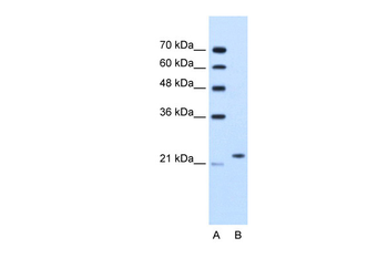 BAG2 Rabbit Polyclonal Antibody