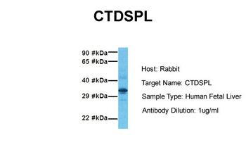 CTDSPL Rabbit Polyclonal Antibody