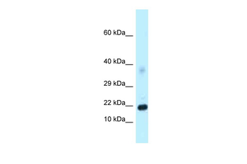 Dkk4 Rabbit Polyclonal Antibody